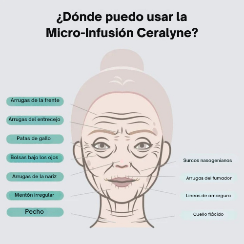 Micro-Infusión Lift Pro + Suero extra gratis